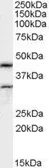Anti-ACTL7B antibody, Internal used in Western Blot (WB). GTX89137