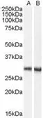 Anti-Dcdc2a antibody, Internal used in Western Blot (WB). GTX89229