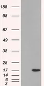 Anti-SH2D1A antibody, Internal used in Western Blot (WB). GTX89320