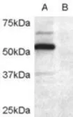 Anti-DCDC2 antibody, Internal used in Western Blot (WB). GTX89389