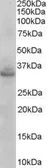 Anti-STX1A / STX1B antibody, N-term used in Western Blot (WB). GTX89481