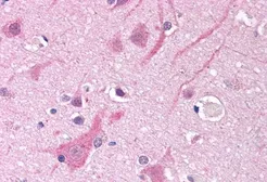 Anti-Nav1.5 antibody, Internal used in IHC (Paraffin sections) (IHC-P). GTX89500