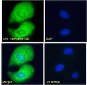 Anti-Adenosine A2b Receptor antibody, C-term used in Immunocytochemistry/ Immunofluorescence (ICC/IF). GTX89506