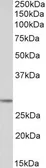 Anti-POMC antibody used in Western Blot (WB). GTX89560