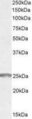 Anti-Synaptogyrin 2 antibody, Internal used in Western Blot (WB). GTX89573