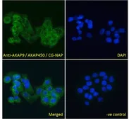 Anti-AKAP9 antibody, C-term used in Immunocytochemistry/ Immunofluorescence (ICC/IF). GTX89583