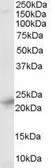 Anti-Synaptogyrin 4 antibody, N-term used in Western Blot (WB). GTX89630