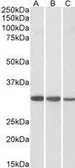 Anti-CAPZB antibody, C-term used in Western Blot (WB). GTX89785