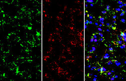 Anti-Iba1 (isoform 1 and 3) antibody, C-term used in IHC (Frozen sections) (IHC-Fr). GTX89792