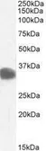 Anti-CBR1 antibody, C-term used in Western Blot (WB). GTX89841