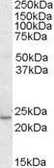 Anti-KLF16 antibody, C-term used in Western Blot (WB). GTX89911